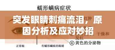 突发眼睛刺痛流泪，原因分析及应对妙招